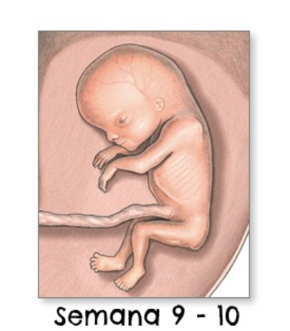 Semana 9 - 10