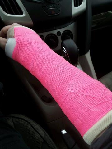 Broken arm and Spraigned wrist