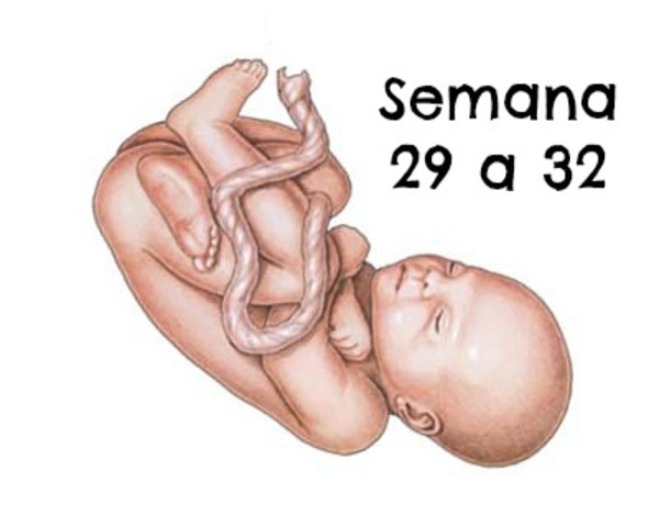 Semanas 29 - 32