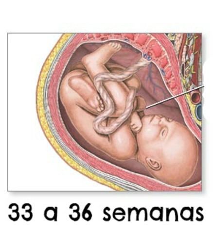 Semanas 33 - 36