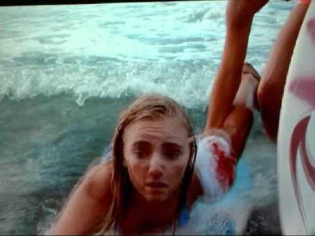 They day Bethany got bit