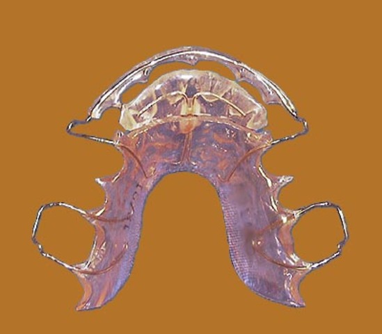 3.3- Imaginary Audience