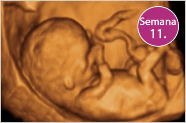 Semana 11