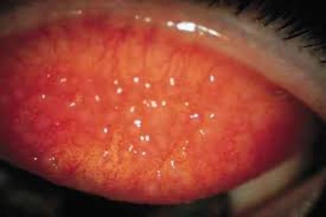 Creacion de L.C diaros