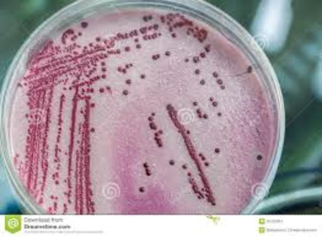 Teoria de la biogénesis. John Tyndall