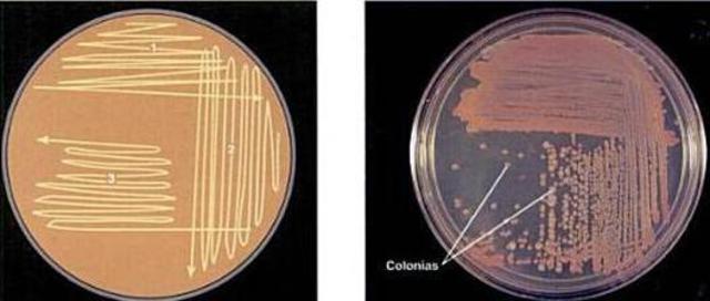 Método de enriquecimiento de cultivos.