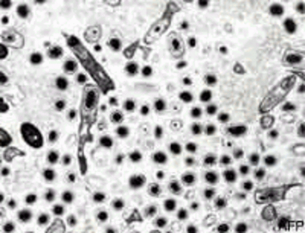 Descubrimiento del virus  BACILLUS ANTHRACIS "Ántrax"