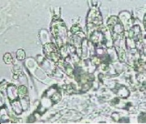 rastros de vida unicelular