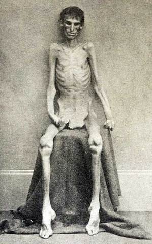 The opening of the confederate war camp of Andersonville