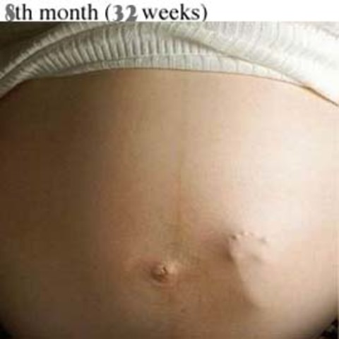 7th month pregnancy