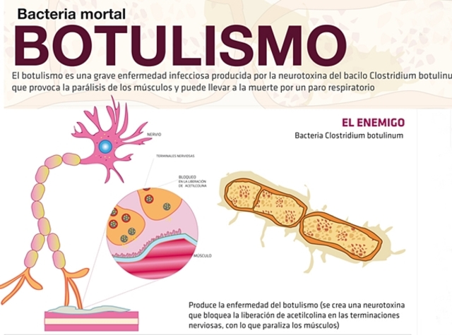 1870 Müller acuñó al botulismo como tal.