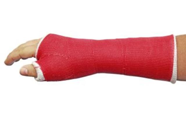 I buckle Fractured my wrist playing basketball