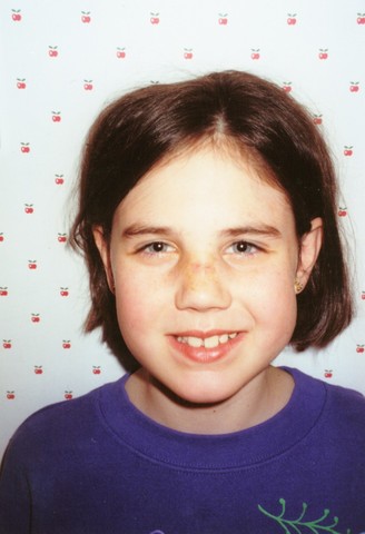 Ms. Baker breaks her nose :(