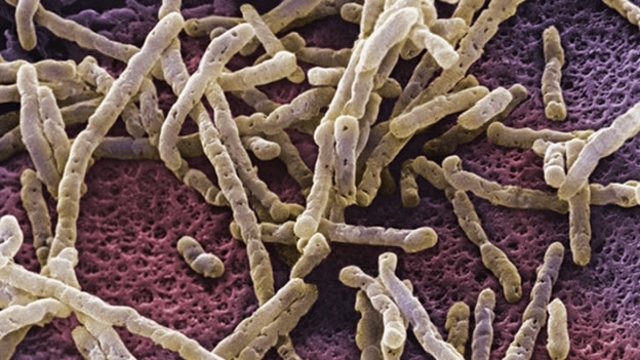 Descubrimiento del Botulismo