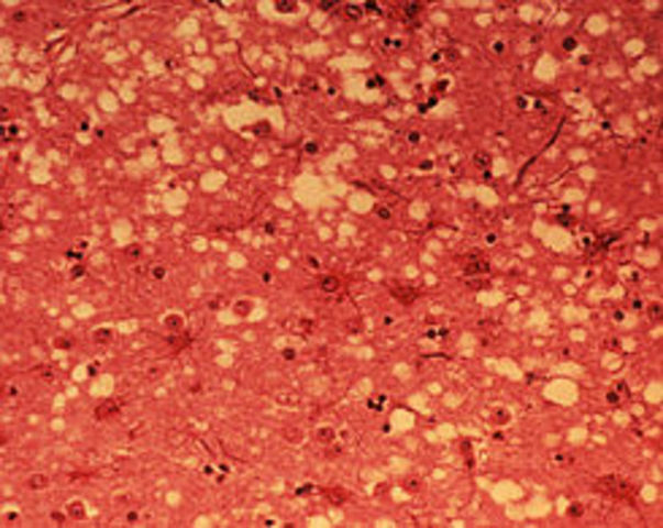 Encefalopatía Espongiforme bovina “vacas locas”