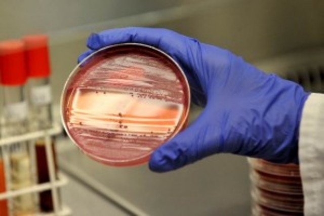 Método para reproducir bacterias en un medio de cultivo