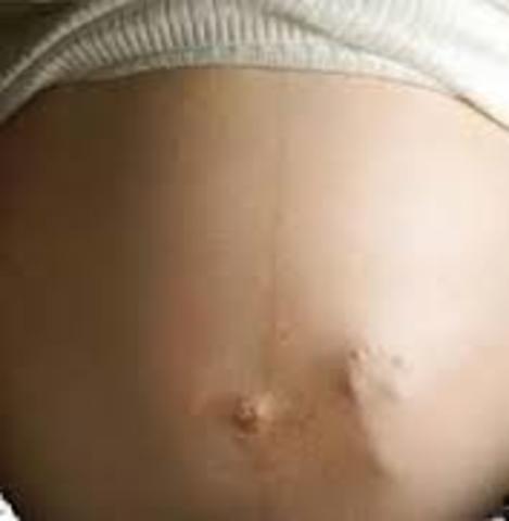 3rd month of pregancy