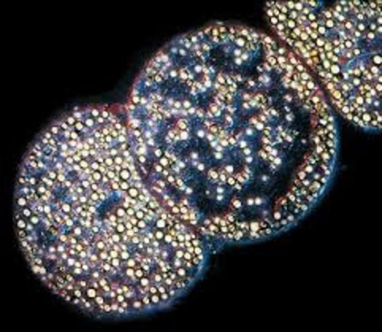 bacteria gigante Thiomargarita namibiensis