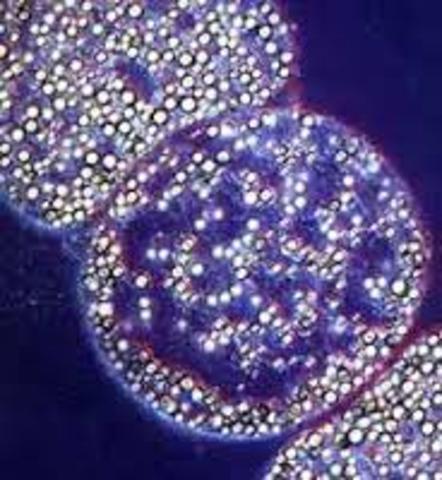 bacteria gigante Thiomargarita namibiensis