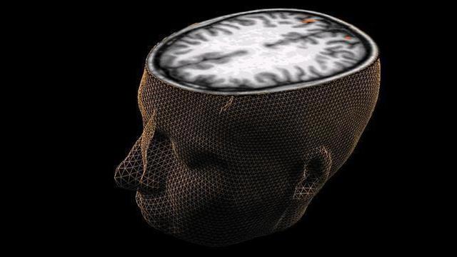 Ver dentro de un cerebro