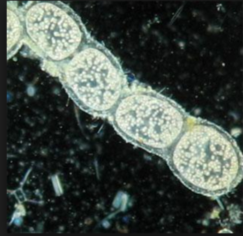 SE DESCUBRE LA BACTERIA GIGANTE THIOMARGARITA NAMIBIENSIS