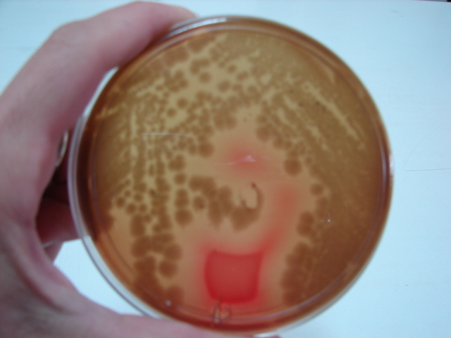 articulo termobacteriologìca