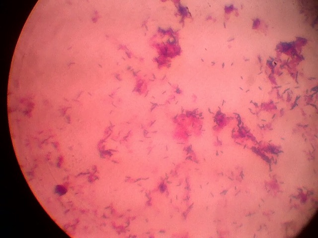 ANIMACULOS EN FUENTES HIDRICAS