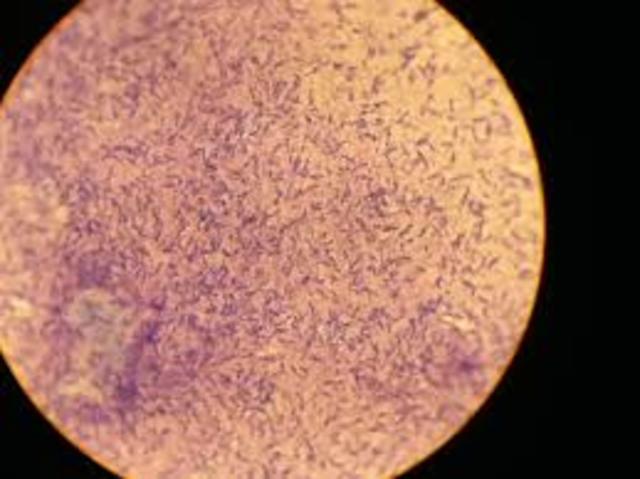 PRIMER METOS DE ESTERILIZACION DE LIQUIDOS QUE CONTIENE ESPORAS DE BACILOS