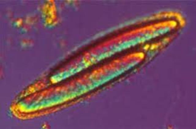 Epulopiscium fishelsoni