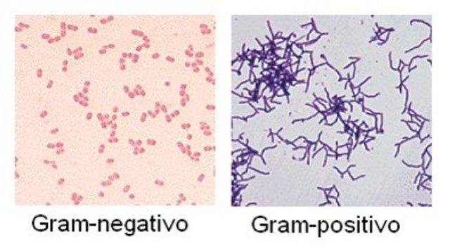 TINCION GRAM EN BACTERIAS