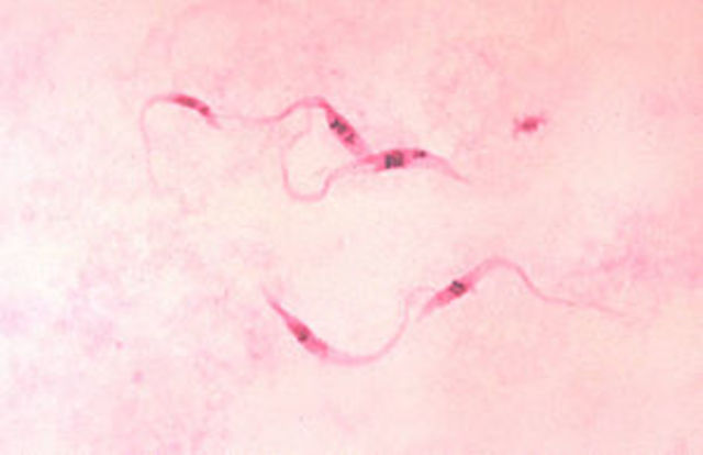 Descubrimiento del parasito Trypanosoma cruzi