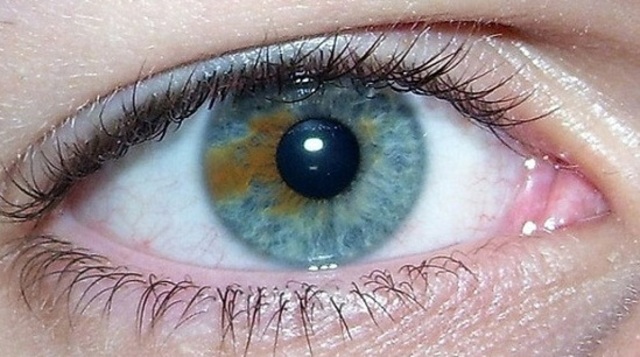 eye color