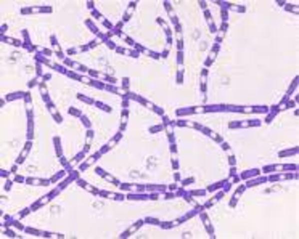 DESCUBRIMIENTO DEL VIRUS BACILLUS ANTHRACIS "Ántrax"