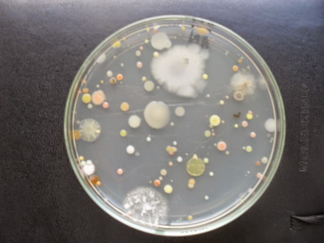 Crecimiento de bacterias en medios sólidos