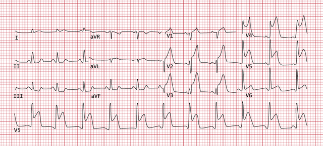 12-lead electrocardiogram