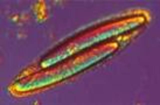 EPULOPISCIUM FISHELSONI