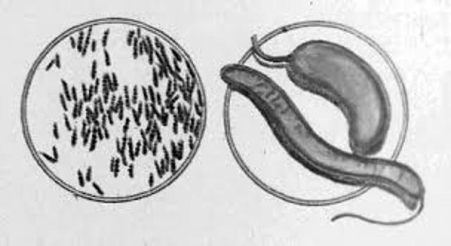 EL ANTRAX ES CAUSADO POR BACILIUS ANTHRACIS
