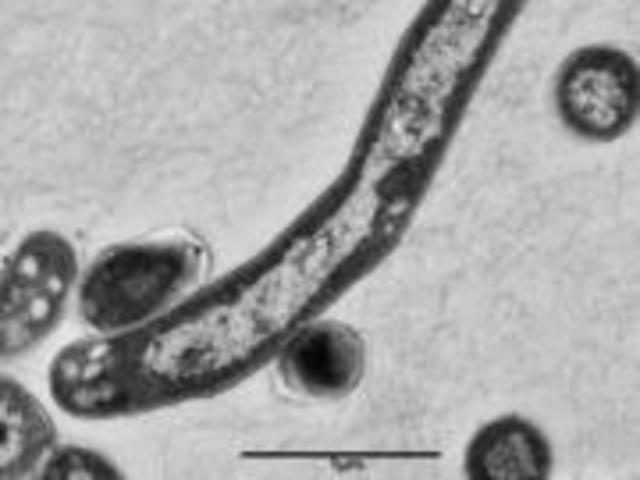 BACTERIA RESPONSABLE DE LA TUBERCULOSIS