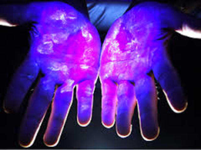 TEORÍA GERMINAL DE LA ENFERMEDAD