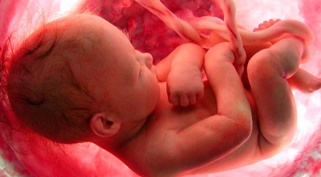 ACEPTA EL ABORTO EN NIÑOS