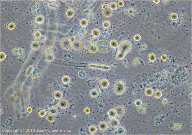 se descubre un hongo en la patata