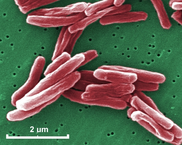 Descubrimieno del Mycobacterium tuberculosis