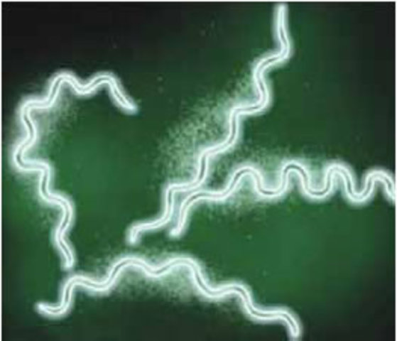 descubrimiento del agente productor de la sifilis