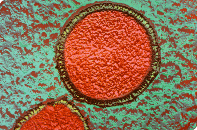 reconocimiento de las archeas como tecer dominio