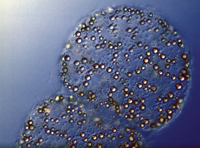 descubribiento de la bacteria thiomargarita namibiensis