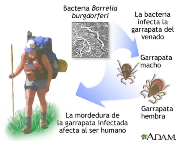 descubrimiento de la bacteria causante de la Borreliosis de Lyme