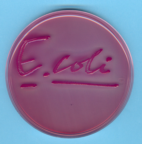 Descubren el E. Coli
