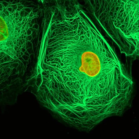 STEWART ¨CAUSA VIRAL DEL CÁNCER HUMANO¨