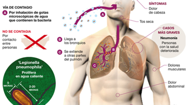 APARICIÓN DE LA ENFERMEDAD DEL LEGIONARIO