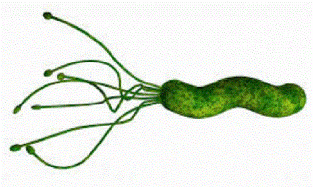 HELICOBACTER PYLORI EN LA ÚLCERA DE ESTÓMAGO.